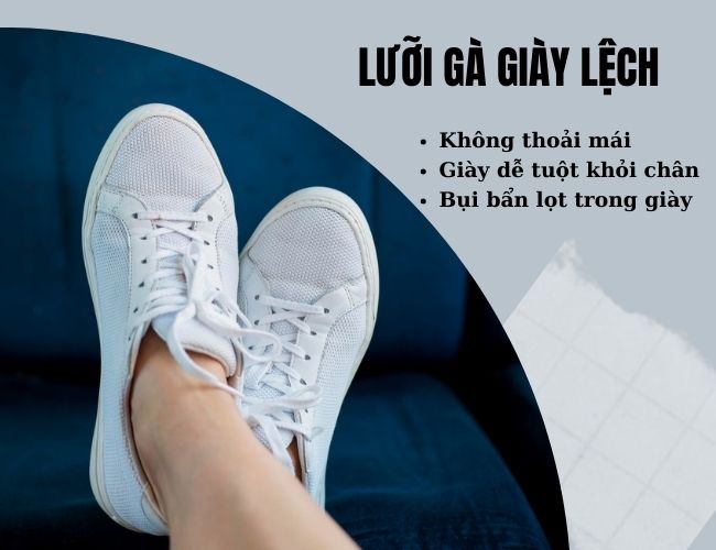 Lưỡi gà giày lệch gây nhiều phiền toái cho người sử dụng