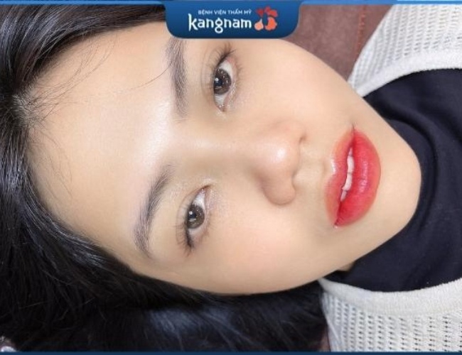 Bệnh viện thẩm mỹ Kangnam