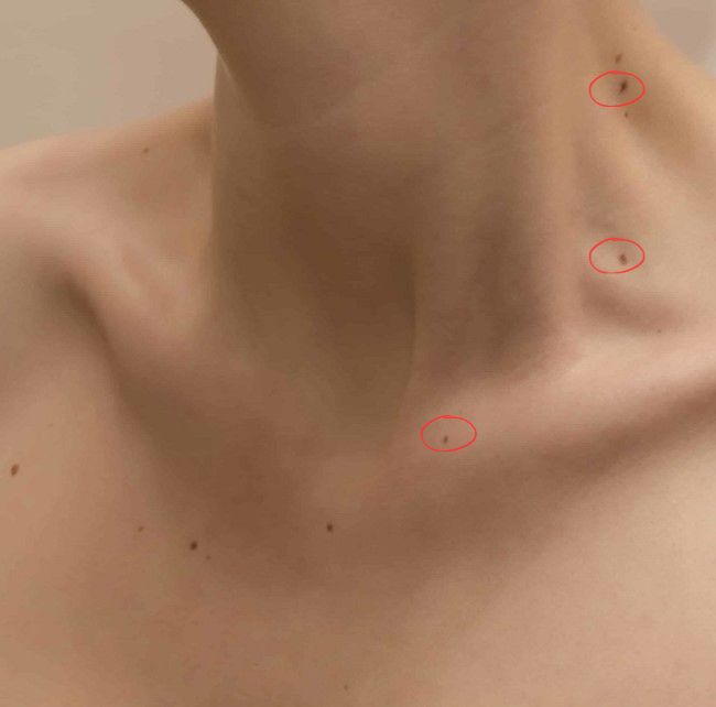 Vận mệnh các vị trí nốt ruồi ở cổ cho nam nữ