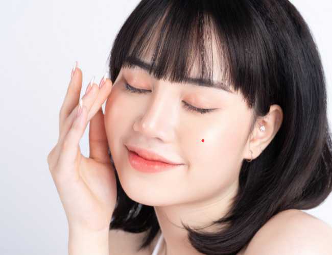 Nốt ruồi son là gì