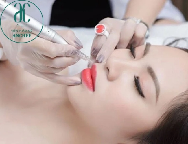 Thẩm mỹ viện AnChee Clinic