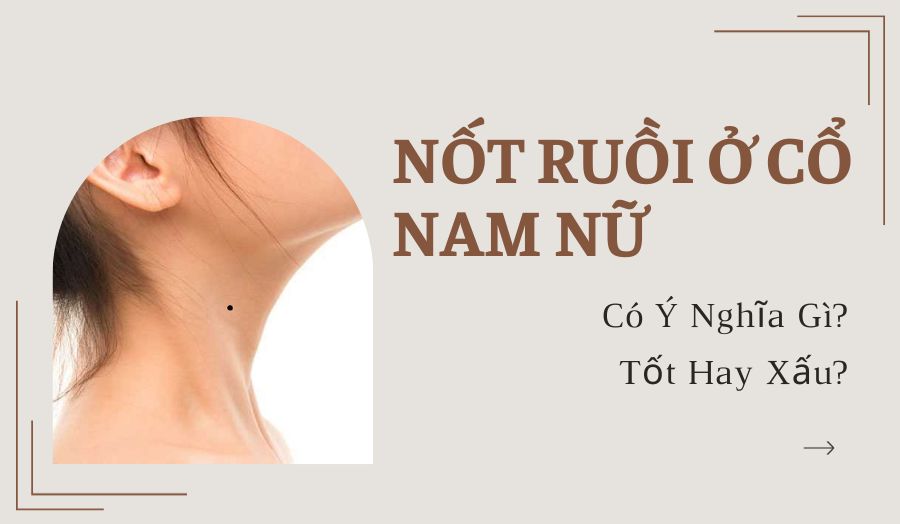 Nốt Ruồi Ở Cổ Là Điềm Lành Hay Xui? Có Nên Xóa Không?