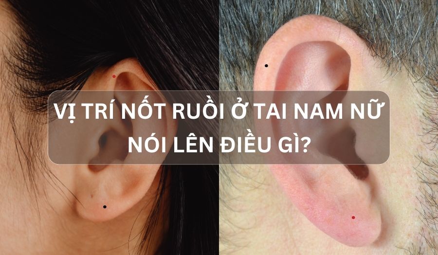 Nốt Ruồi Ở Tai Nam Nữ Nói Lên Điều Gì? Tốt Hay Xấu?