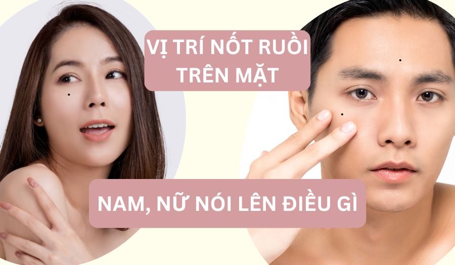 Vị Trí Nốt Ruồi Trên Mặt Nam Nữ Nói Lên Điều Gì?